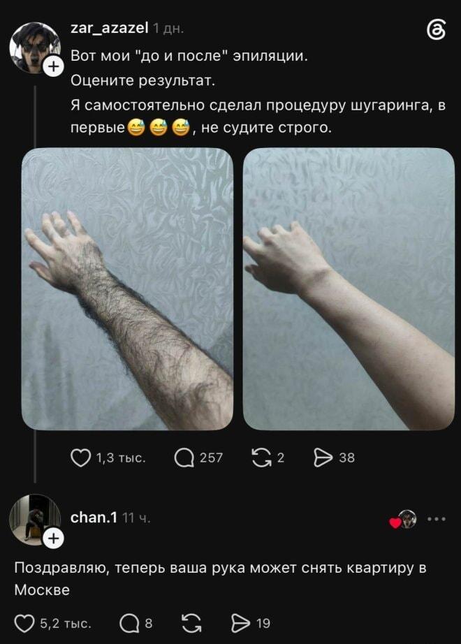 Рука до и после эпиляции